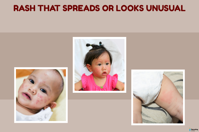 when to call the doctor for baby symptoms