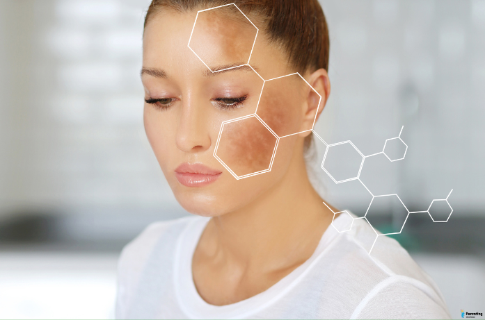 treating postpartum pigmentation and melasma with skin care