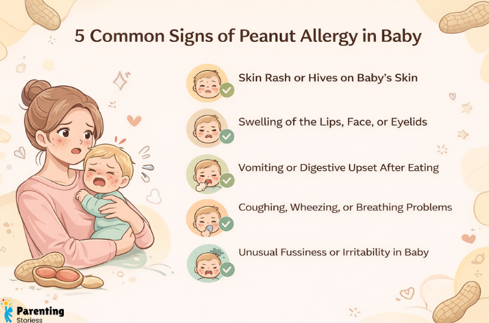 5 Common Signs of Peanut Allergy in Baby