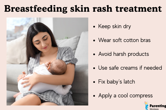 Breastfeeding skin rash treatment