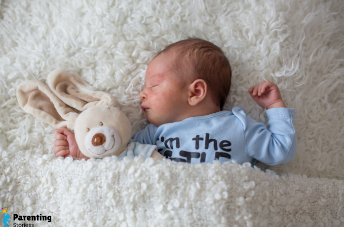Baby Neck Rash